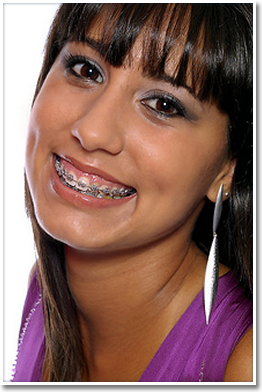 Palatal Expander